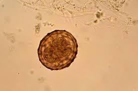 В воде Зейского водохранилища на «Золотых песках» обнаружены яйца аскарид