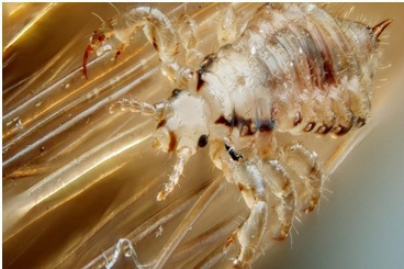 О мерах по профилактике педикулеза