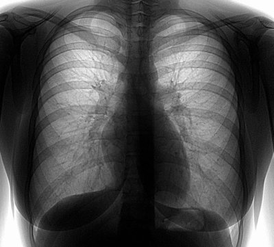 О проведении флюорообследования всем желающим