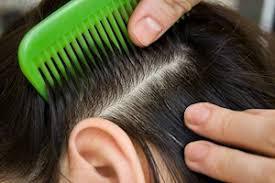 Как предотвратить появление педикулеза?