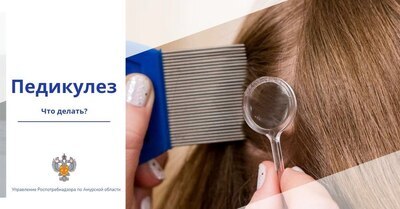 Ой, чешется! 