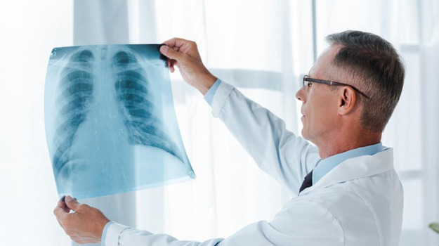 Пневмония маскируется под грипп и ОРВИ 